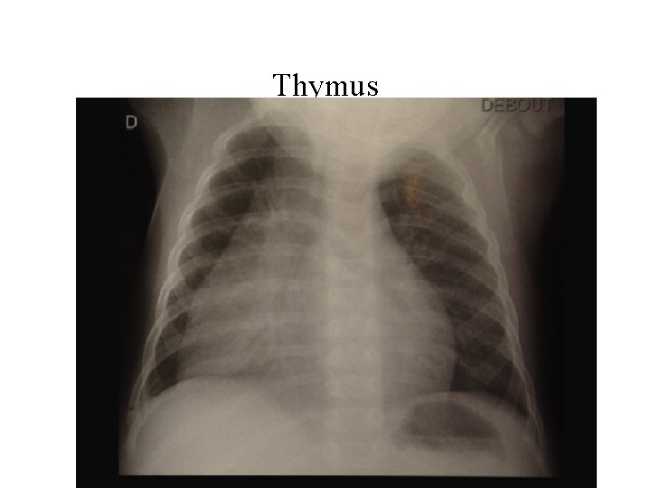 Thymus 