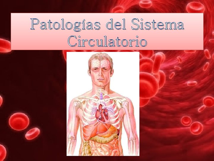 Patologías del Sistema Circulatorio 