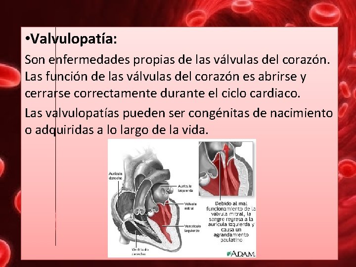  • Valvulopatía: Son enfermedades propias de las válvulas del corazón. Las función de
