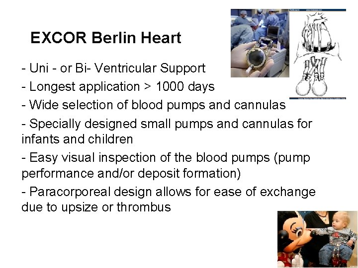 EXCOR Berlin Heart - Uni - or Bi- Ventricular Support - Longest application >