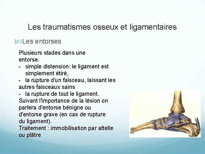 Les traumatismes osseux et ligamentaires Les entorses Plusieurs stades dans une entorse. - simple