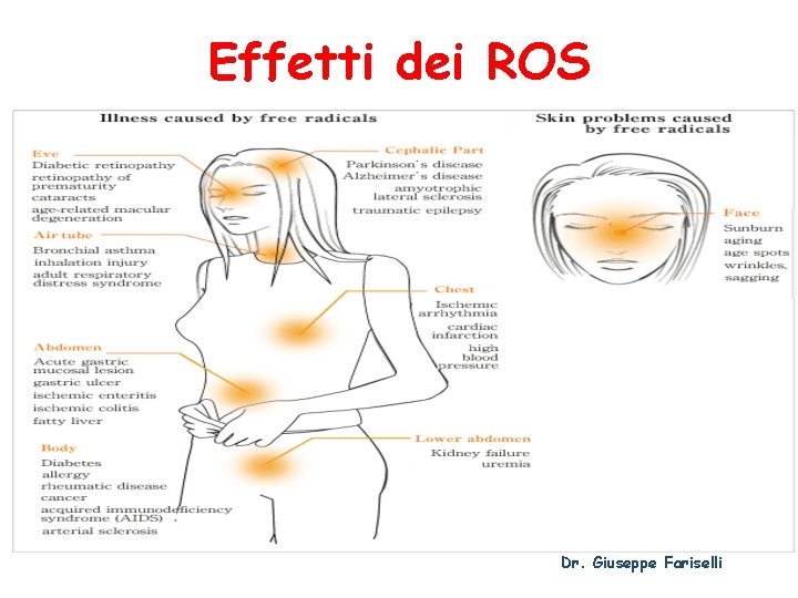 Effetti dei ROS Dr. Giuseppe Fariselli 