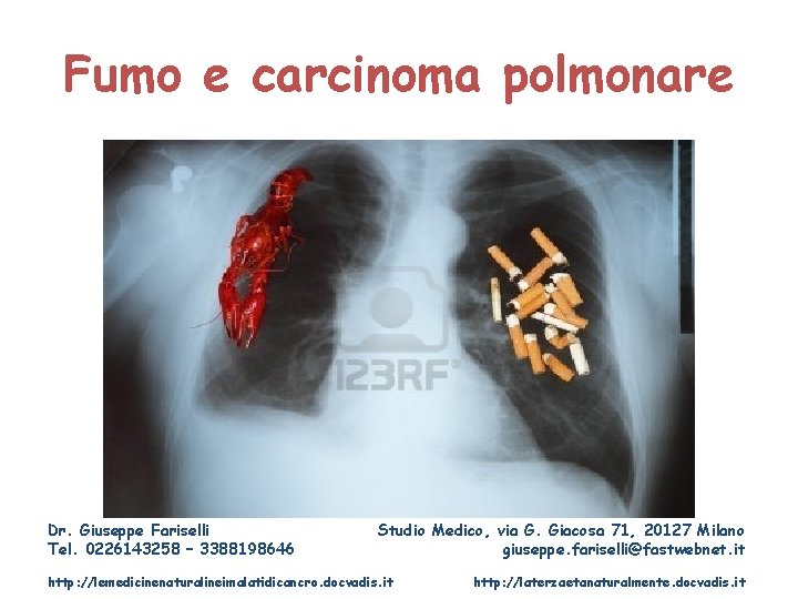 Fumo e carcinoma polmonare Dr. Giuseppe Fariselli Tel. 0226143258 – 3388198646 Studio Medico, via