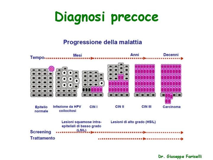 Diagnosi precoce Dr. Giuseppe Fariselli 