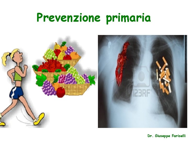 Prevenzione primaria Dr. Giuseppe Fariselli 