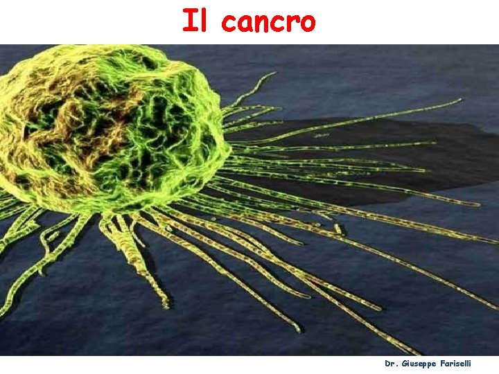 Il cancro Dr. Giuseppe Fariselli 