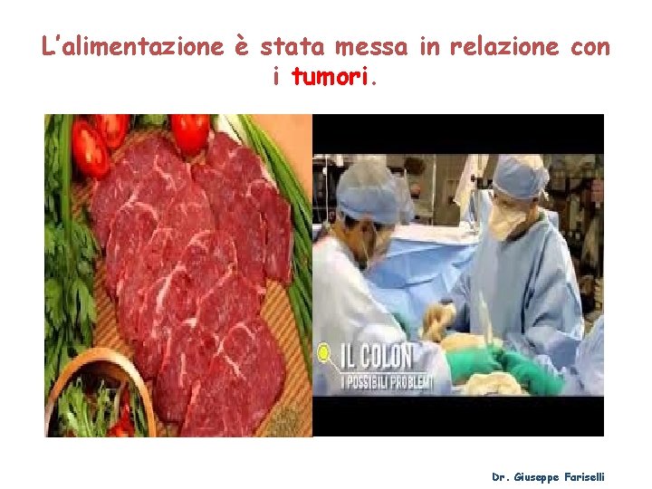 L’alimentazione è stata messa in relazione con i tumori. Dr. Giuseppe Fariselli 