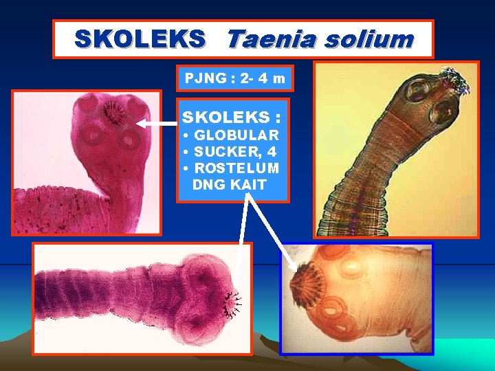 SKOLEKS Taenia solium PJNG : 2 - 4 m SKOLEKS : • GLOBULAR •