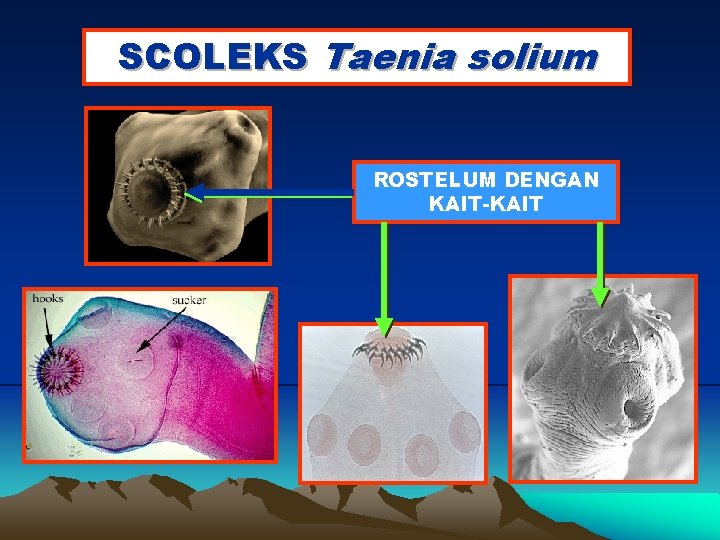 SCOLEKS Taenia solium ROSTELUM DENGAN KAIT-KAIT 