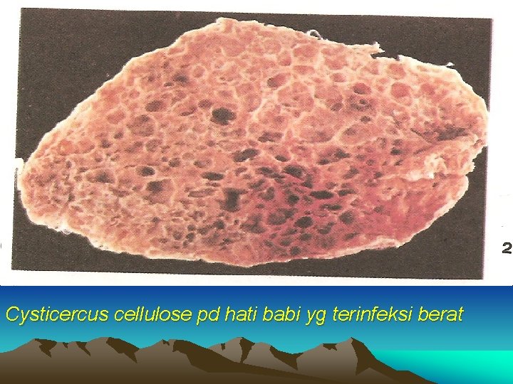 Cysticercus cellulose pd hati babi yg terinfeksi berat 
