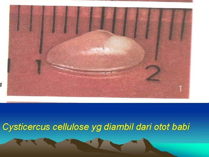 Cysticercus cellulose yg diambil dari otot babi 