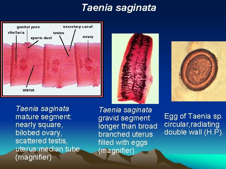 Taenia saginata mature segment: nearly square, bilobed ovary, scattered testis, uterus: median tube (magnifier)