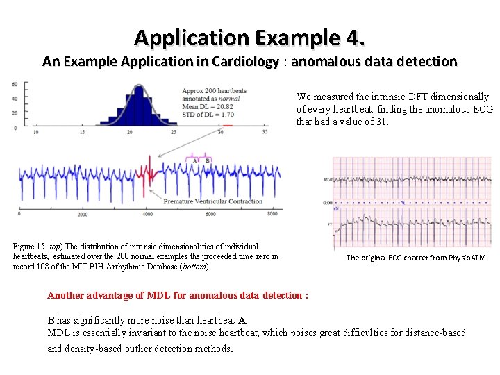 Application Example 4. An Example Application in Cardiology : Cardiology anomalous data detection We