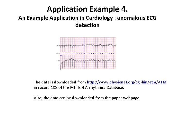 Application Example 4. An Example Application in Cardiology : Cardiology anomalous ECG detection The