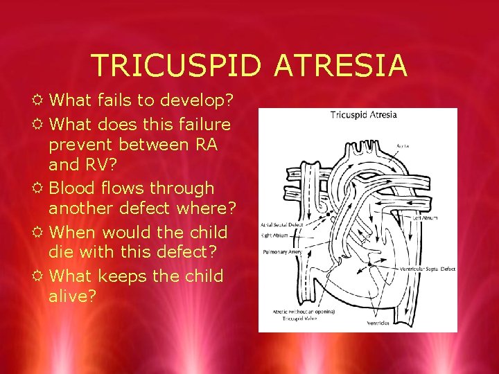 TRICUSPID ATRESIA R What fails to develop? R What does this failure prevent between