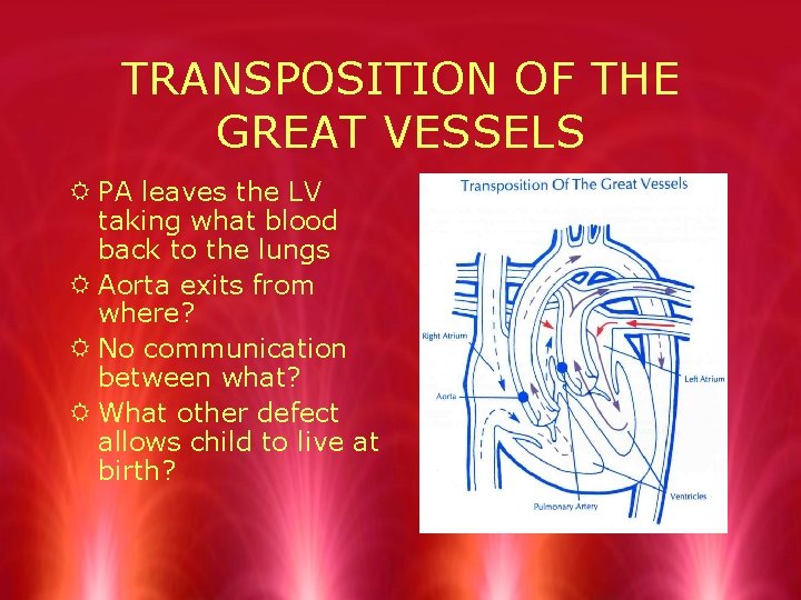 TRANSPOSITION OF THE GREAT VESSELS R PA leaves the LV taking what blood back