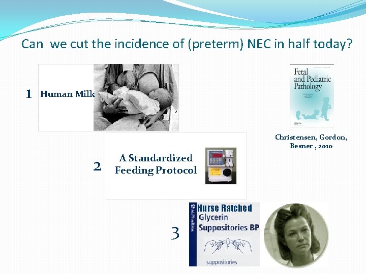 Can we cut the incidence of (preterm) NEC in half today? 1 Human Milk