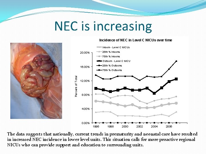 NEC is increasing Incidence of NEC in Level C NICUs over time Inborn -