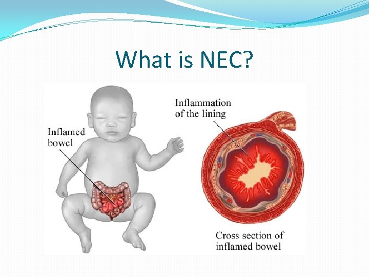 What is NEC? 