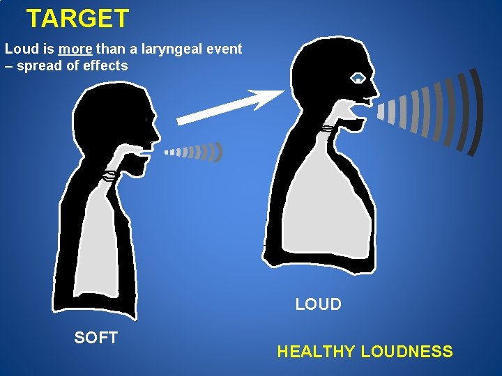TARGET Loud is more than a laryngeal event – spread of effects LOUD SOFT