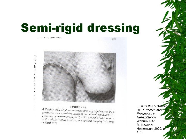 Semi-rigid dressing Lusardi MM & Nielsen CC. Orthotics and Prosthetics in Rehabilitation. Woburn, MA: