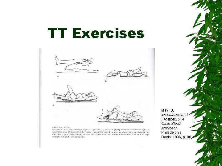 TT Exercises May, BJ. Amputation and Prosthetics: A Case Study Approach. Philadelphia: Davis; 1996,
