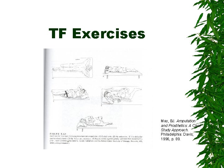 TF Exercises May, BJ. Amputation and Prosthetics: A Case Study Approach. Philadelphia: Davis; 1996,