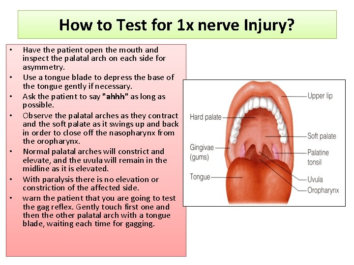 How to Test for 1 x nerve Injury? • • Have the patient open