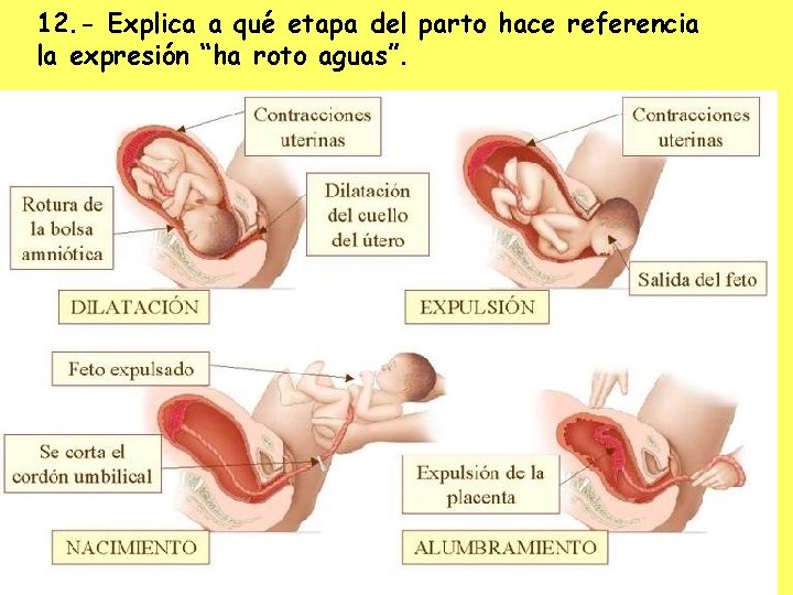 12. - Explica a qué etapa del parto hace referencia la expresión “ha roto