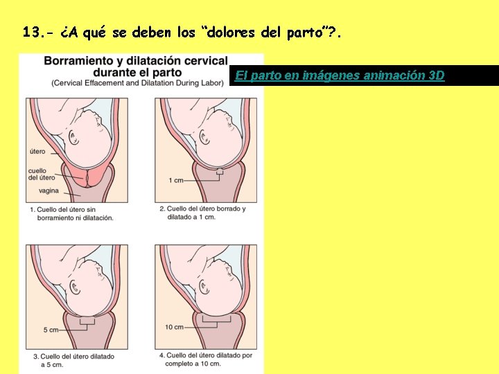 13. - ¿A qué se deben los “dolores del parto”? . El parto en