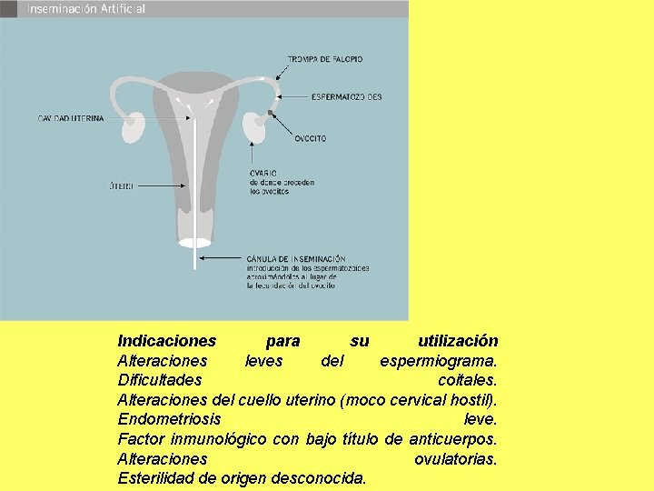 Indicaciones para su utilización Alteraciones leves del espermiograma. Dificultades coitales. Alteraciones del cuello uterino