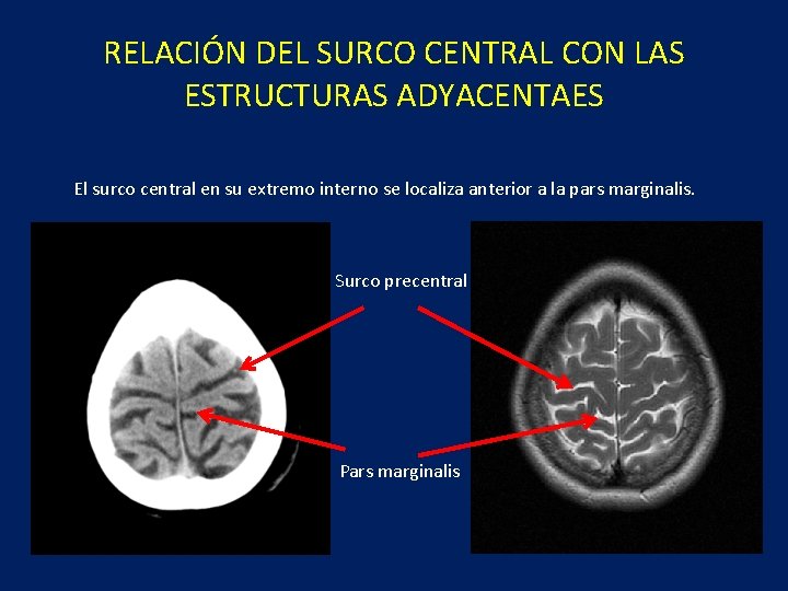 RELACIÓN DEL SURCO CENTRAL CON LAS ESTRUCTURAS ADYACENTAES El surco central en su extremo