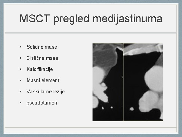 MSCT pregled medijastinuma • Solidne mase • Cistične mase • Kalcifikacije • Masni elementi