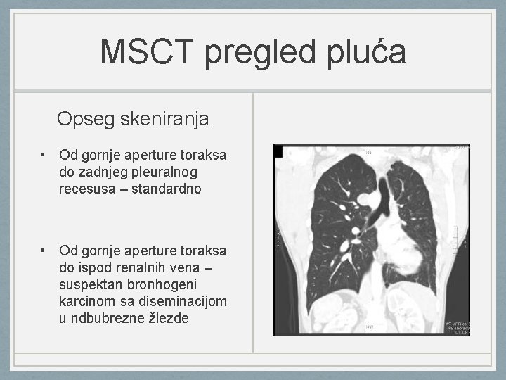 MSCT pregled pluća Opseg skeniranja • Od gornje aperture toraksa do zadnjeg pleuralnog recesusa