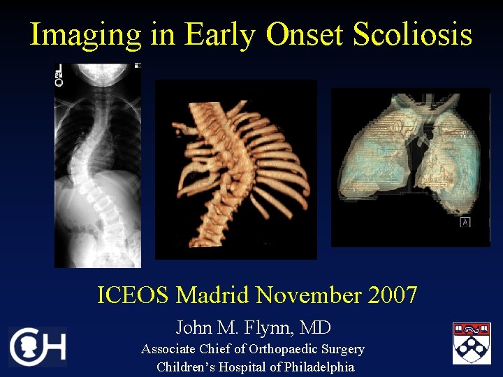 Imaging in Early Onset Scoliosis ICEOS Madrid November 2007 John M. Flynn, MD Associate