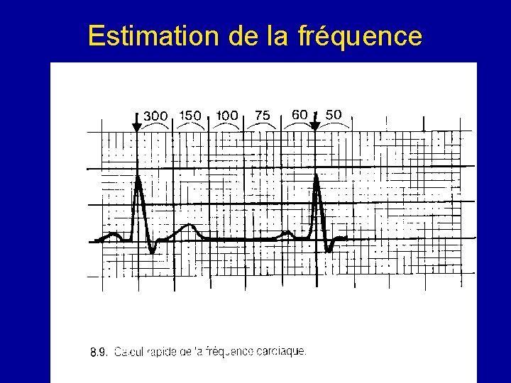 Estimation de la fréquence 