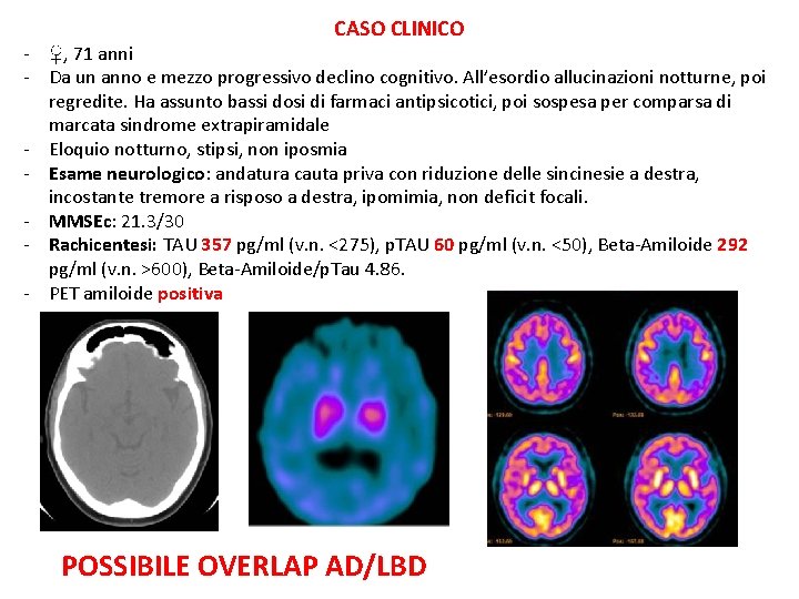CASO CLINICO - ♀, 71 anni - Da un anno e mezzo progressivo declino CASO CLINICO - ♀, 71 anni - Da un anno e mezzo progressivo declino