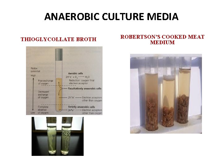 ANAEROBIC CULTURE MEDIA THIOGLYCOLLATE BROTH ROBERTSON’S COOKED MEAT MEDIUM 