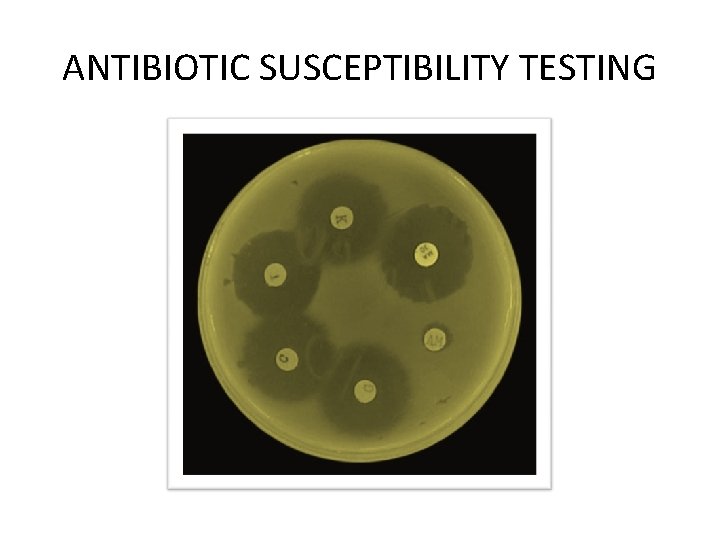 ANTIBIOTIC SUSCEPTIBILITY TESTING 