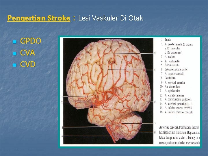 Pengertian Stroke : Lesi Vaskuler Di Otak n n n GPDO CVA CVD 