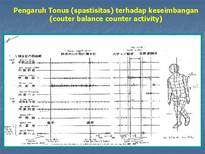 Pengaruh Tonus (spastisitas) terhadap keseimbangan (couter balance counter activity) 