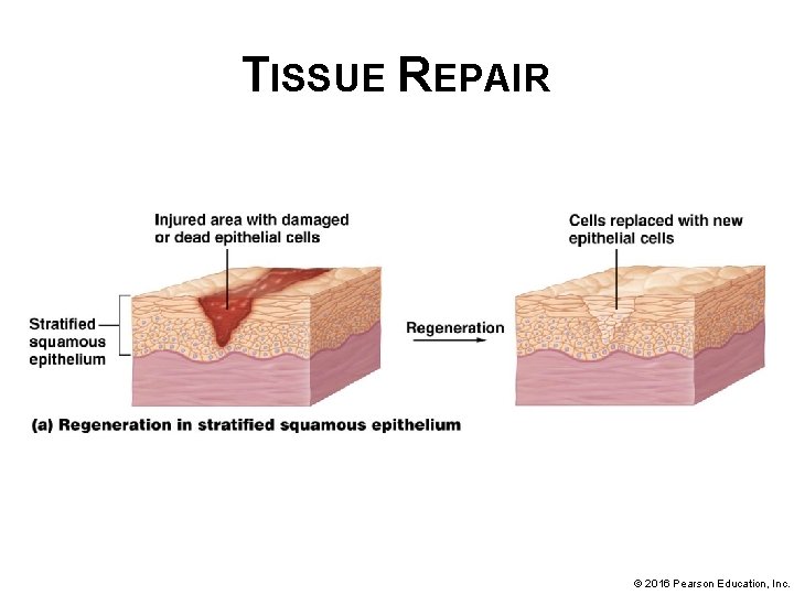 TISSUE REPAIR © 2016 Pearson Education, Inc. 