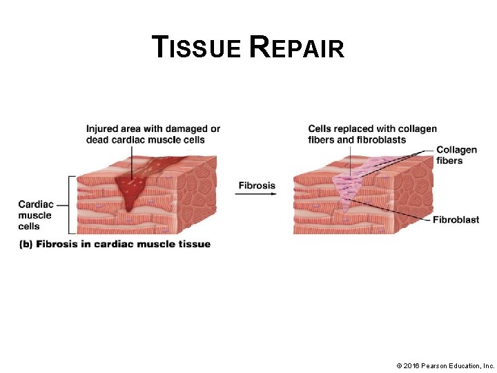 TISSUE REPAIR © 2016 Pearson Education, Inc. 