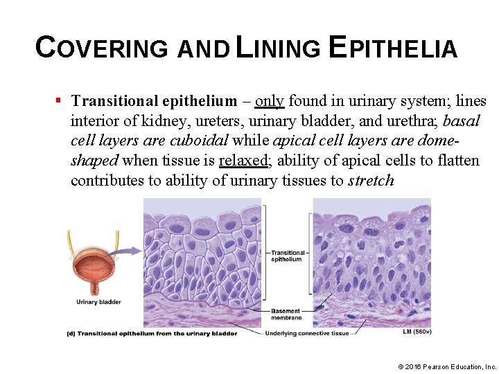 COVERING AND LINING EPITHELIA § Transitional epithelium – only found in urinary system; lines