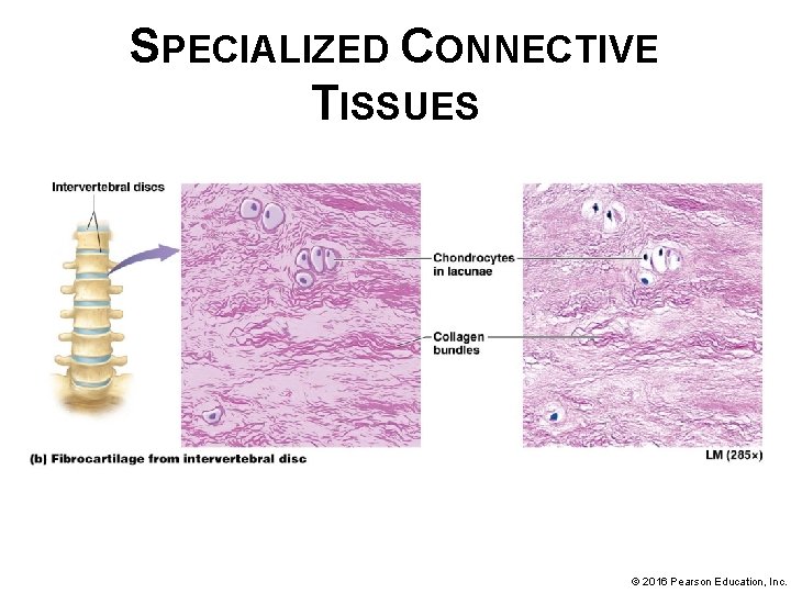 SPECIALIZED CONNECTIVE TISSUES © 2016 Pearson Education, Inc. 