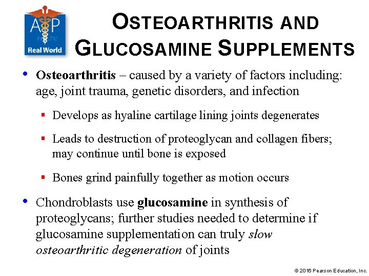 OSTEOARTHRITIS AND GLUCOSAMINE SUPPLEMENTS • Osteoarthritis – caused by a variety of factors including: