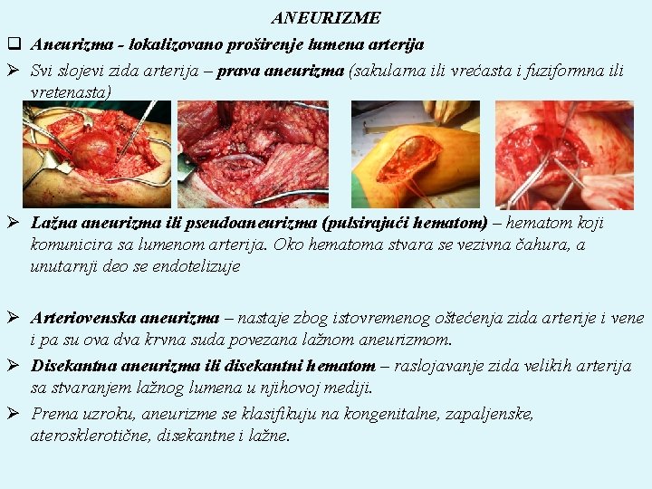 Aneurizma poplitealne arterije - Zdravo budi