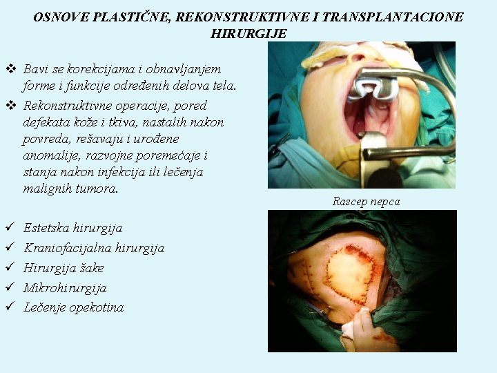 OSNOVE PLASTIČNE, REKONSTRUKTIVNE I TRANSPLANTACIONE HIRURGIJE v Bavi se korekcijama i obnavljanjem forme i