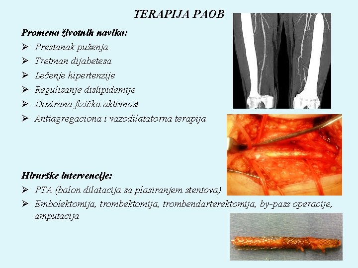 TERAPIJA PAOB Promena životnih navika: Ø Prestanak pušenja Ø Tretman dijabetesa Ø Lečenje hipertenzije