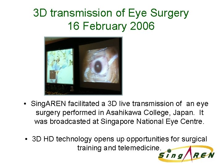 3 D transmission of Eye Surgery 16 February 2006 • Sing. AREN facilitated a